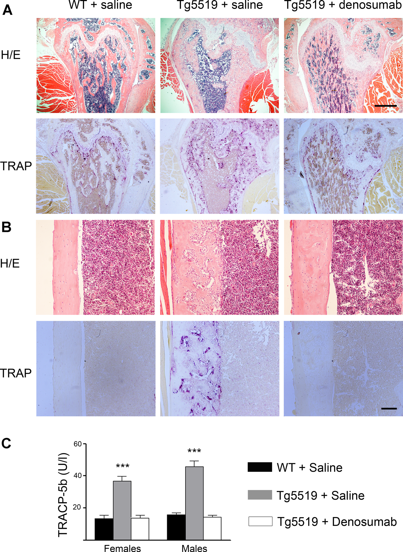 Fig. 6. Therapeutic effects of denosumab in Tg5519 mice.