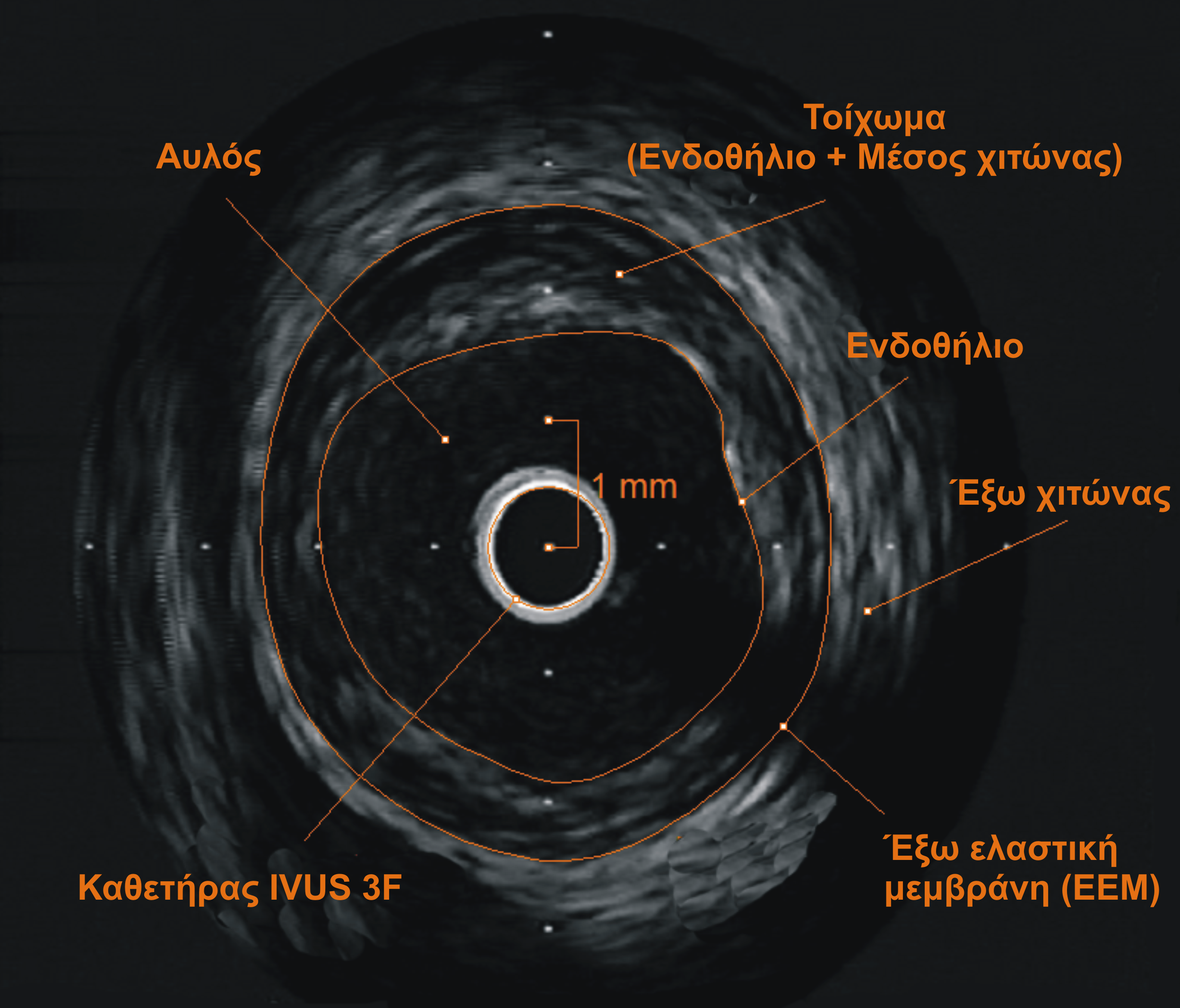 ΚΕΦΑΛΑΙΟ 4. ΟΡΘΗ ΑΝΑΚΑΤΑΣΚΕΥΗ ΑΓΓΕΙΩΝ (αʹ) 20 (ϐʹ) Σχήµα 4.