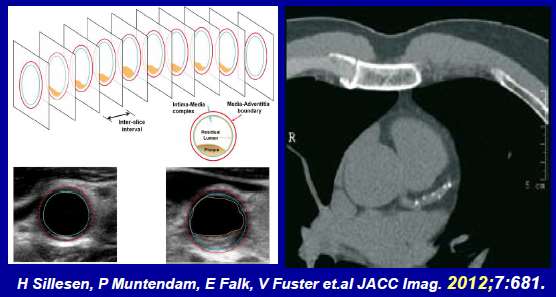 Carotid