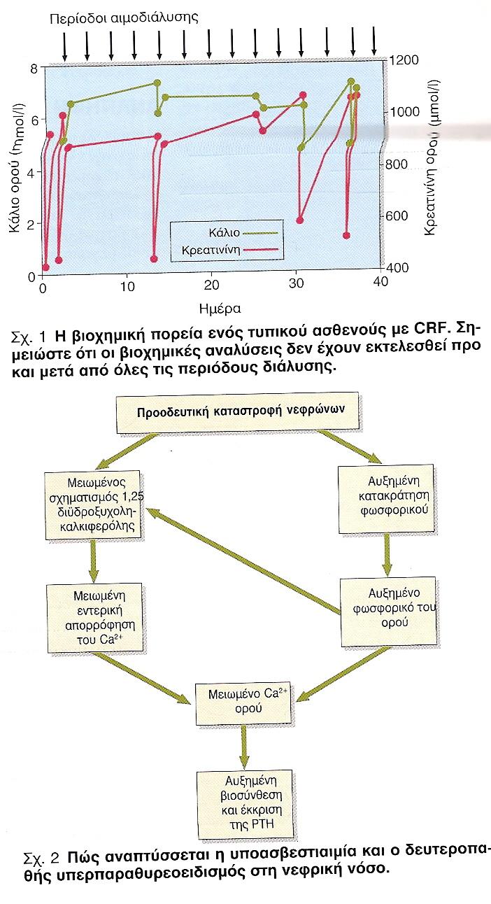 1) ΟΡΘΟΧΡΩΜΗ ΟΡΘΟΚΥΤΤΑΡΙΚΗ ΑΝΑΙΜΙΑ ΑΠΌ ΕΛΛΕΙΨΗ ΕΡΥΘΡΟΠΟΙΗΤΙΝΗΣ 2) ΟΓΚΟ- ΝΑ+ΕΞΑΡΤΩΜΕΝΗ ΥΠΕΡΤΑΣΗ 3) ΝΕΦΡΙΚΗ ΟΣΤΕΟΔΥΣΤΡΟΦΙΑ: Α)