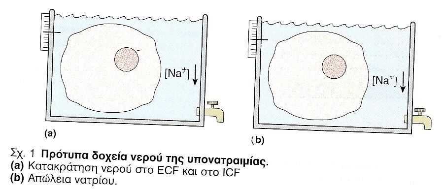 ΥΠΟΝΑΤΡΙΑΙΜΙΑ 1) ΚΑΤΑΚΡΑΤΗΣΗ ΝΕΡΟΥ (σύνδρομο απρόσφορης έκκρισης