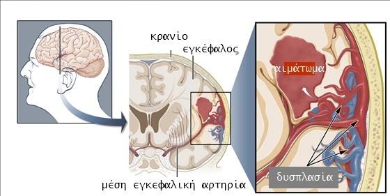 Τοποθετείστε τον ασθενή στο κρεβάτι με μαξιλάρι κάτω από το κεφάλι του Αφαιρέστε την ξένη οδοντοστοιχία, αν έχει Χαλαρώστε τα ρούχα του