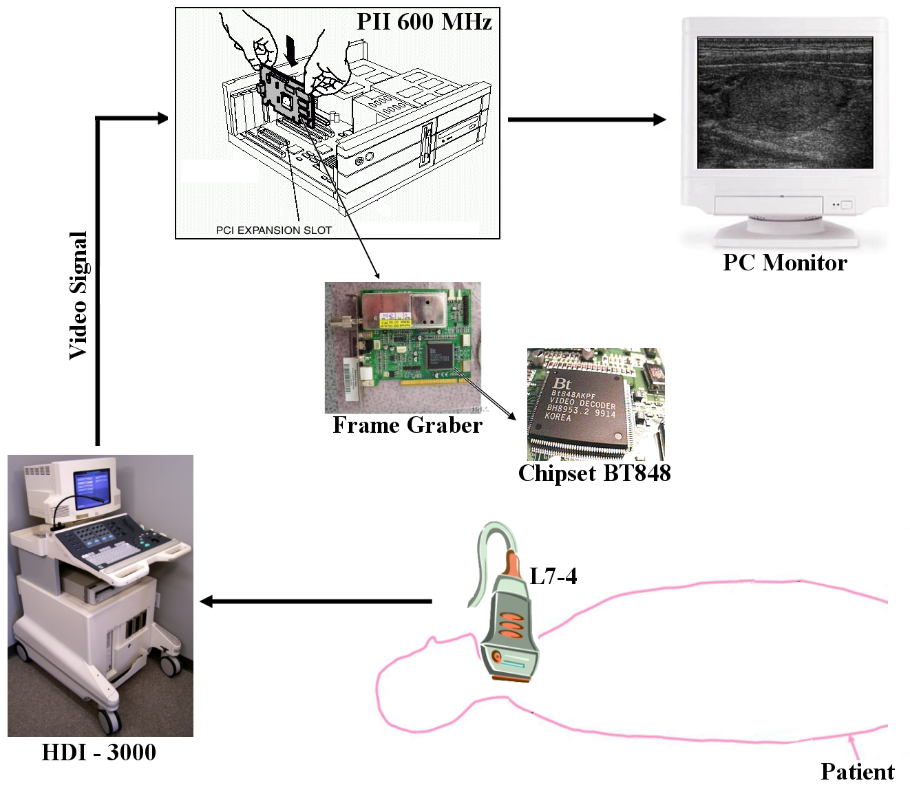 Chapter 3 The frame grabber utilized in the present study is the Miro PCTV (Pinnacle Systems Inc. 80 N.Bernardo Avenue Mountain View, CA 94043) with the BT 848 chipset integrated.