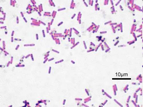 Υπεύθυνοι µικροοργανισµοί Bacillus cereus Clostridium perfringens Clostridium botulinum Campylobacter jejuni Escherichia coli Listeria monocytogenes Salmonella sp. Brucella sp. Shigella sp.