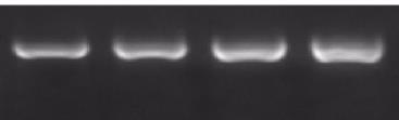 Αποτελέσματα IL-6 (560bp) GAPDH (263bp) IL-6 (560bp) GAPDH (263bp) TGF-β1 - ng/ml MIF ng/ml Σχήμα 2.