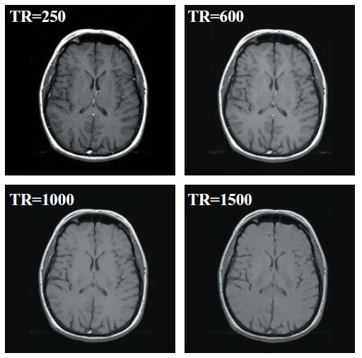 TE = 10ms