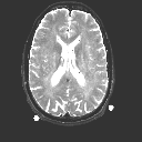 εικόνες με παλμοσειρά spin - echo TE = 20 ms TE = 40 ms TE = 60 ms TE = 100