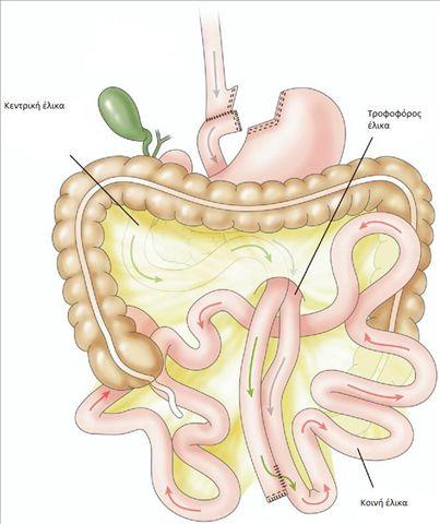 ΓΑΣΡΙΚΗ ΠΑΡΑΚΑΜΨΗ ΚΑΣΑ ROUX-n-Y