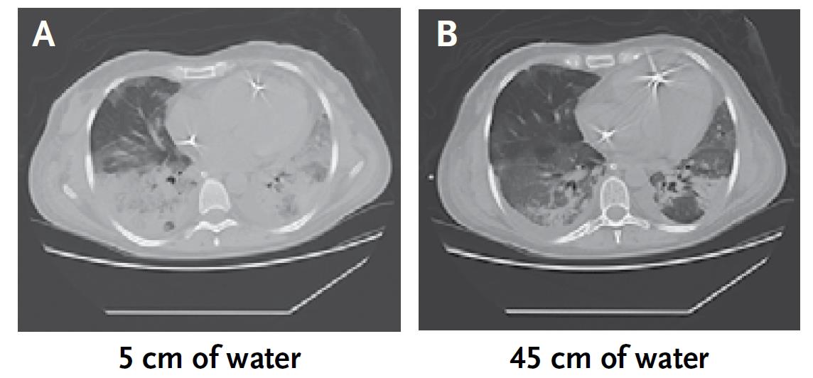 JM NEJM