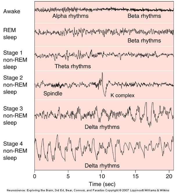 Ηλεκτροεγκεφαλογράφημα (EEG) Το ΗΕΓ μπορεί να διαγνώσει διαταραχές και ανωμαλίες του ύπνου Ύπνος Μια ενεργητική διαδικασία Στέρηση ύπνου = καταστροφικές παρενέργειες Το σώμα απαιτεί ύπνο REM (Rapid