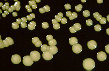 Ζυμομύκητες Μονοκύτταροι μονοπύρηνοι οργανισμοί Βλαστοκονίδια ή βλαστοσπόρια Ψευδοϋφές: αλυσίδες