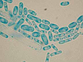Ταξινόμηση μυκήτων ιατρικής σημασίας Βασιδιομύκητες και ατελείς μύκητες Βασιδιομύκητες Ψευδοϋφές (σπάνια) Βασιδιοσπόριο Βλαστοκονίδιο Ανάμορφοι (ατελείς)