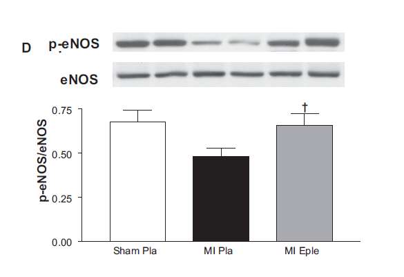 Mineralocorticoid receptor blockade