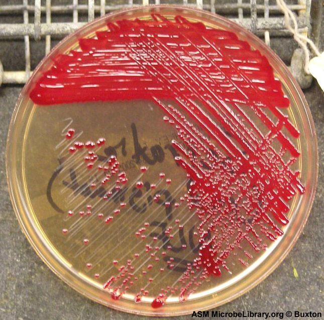 Pseudomonas