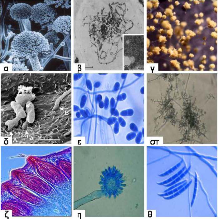 Θεωρητικό Μέρος Σχήµα 1: Χηµική δοµή των Τριχοθυκένιων Σχήµα 2: α)aspergilus flavus, β)penicillium citrinum,