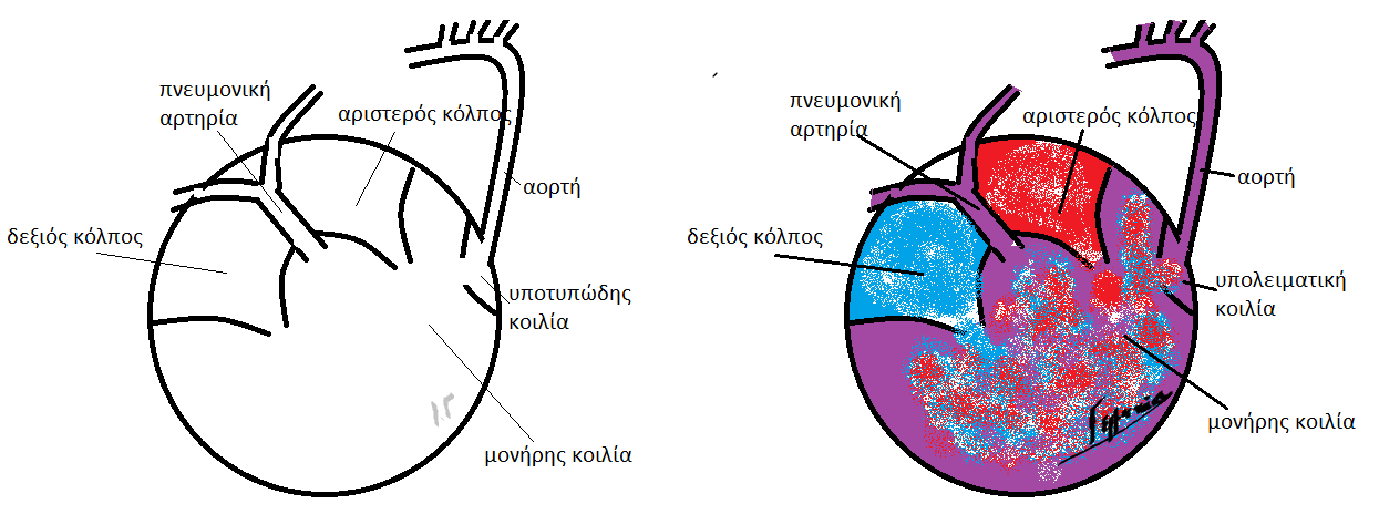 και τη χορήγηση µορφίνης, οξυγόνου και αναστολέων β-αδρενεργικών υποδοχέων. Σε εξειδικευµένα κέντρα, η ολική χειρουργική διόρθωση ανοικτής καρδιάς γίνεται πριν την ηλικία του ενός έτους.