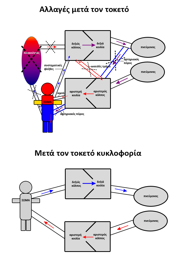 πτώση πιέσεων πνευµονικής κυκλοφορίας, αύξηση πιέσεων συστηµατικής κυκλοφορίας, αύξηση µερικής τάσης οξυγόνου στη συστηµατική κυκλοφορία, σύνδεση σε σειρά των δύο κυκλοφοριών, σύγκλειση ωοειδούς