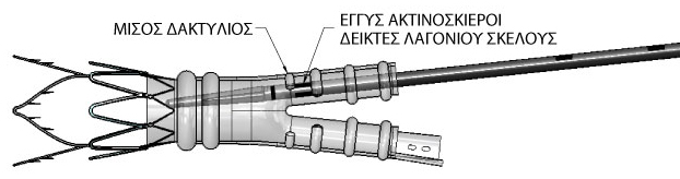 Εισαγωγή και έκπτυξη του ετερόπλευρου σκέλους 1 Ανατρέξτε στην ενότητα «Προετοιμασία του συστήματος (ή των συστημάτων) εφαρμογής» για τα βήματα προετοιμασίας του συστήματος εφαρμογής.