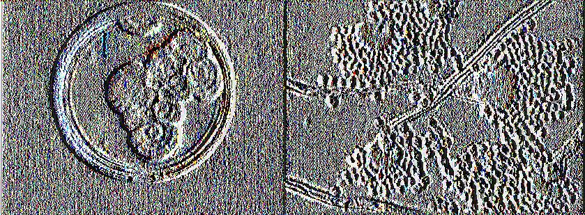 Εικόνα 18: Αριστερά: Αποικίες του μύκητα του γένους Pénicillium σε τρυβλίο Pétri σε θρεπτικό υπόστρωμα.