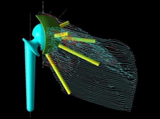 measurements resected bone weld shaft cavity and strain gauges L P axial torque M bone cement stem