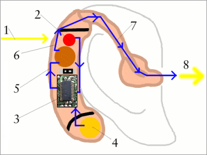 11 Σχήμα 1.6 Μέρη βοηθήματος ακοής 1.5 Χρήση βρόχου αυτομάτου ελέγχου του κέρδους σε βοηθήματα ακοής Η απώλεια ακοής είναι μία από τις πιο συνηθισμένες βλάβες του ανθρώπινου οργανισμού.