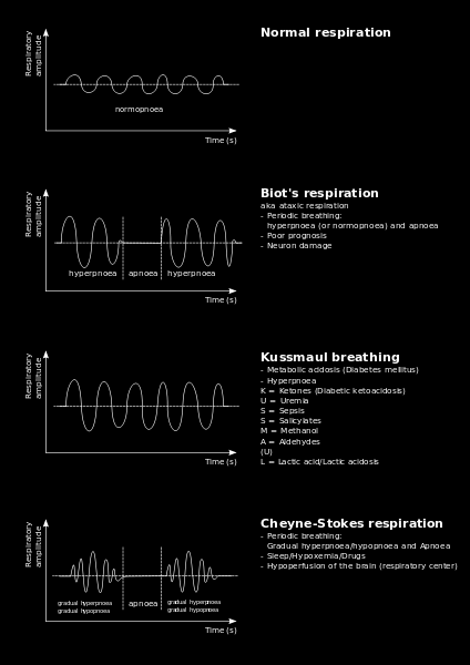 Τύπος αναπνοής Η αναπνοή Cheyne-Stokes χαρακτηρίζεται από περίοδο αυξανόμενου βάθους και ρυθμού αναπνοών που ακολουθείται από περίοδο μειωμένης αναπνευστικής προσπάθειας και συχνότητας και συνήθως