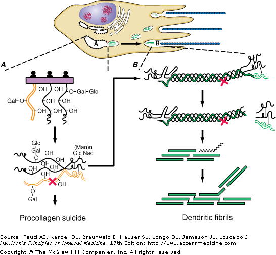 Μεταλλάξεις στην GGN-NNN-NNN (Gly-X-Y) Αντικατάσταση Χ ή Υ με Cys : Διατάραξη της δομής της τριπλής έλικας αλλά χωρίς σοβαρά συμπτώματα (Steinmann, 1983) Αντικατάσταση Gly με Cys : Παρουσία 1