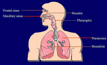 Θεραπευτικές επιλογές για λοιμώξεις αναπνευστικού Πενικιλλίνες