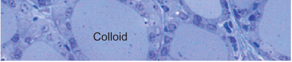 FIGURE 3.2 Low power photomicrograph of a rat thyroid gland.