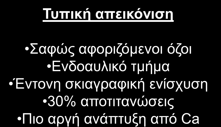 Τυπική απεικόνιση Σαφώς αφοριζόμενοι όζοι Ενδοαυλικό τμήμα Έντονη σκιαγραφική ενίσχυση 30%