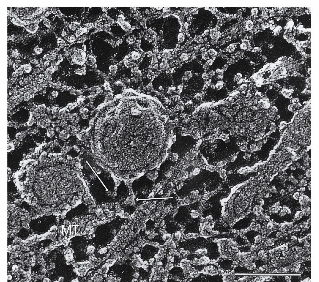 Ταχεία Νευραξονική Μεταφορά Μικροφωτογραφία µε Ηλεκτρονικό Μικροσκόπιο (Μικροσωληνίσκοι, Κυστίδια ΜόριαΚινησίνης) Κινησίνη : ATP