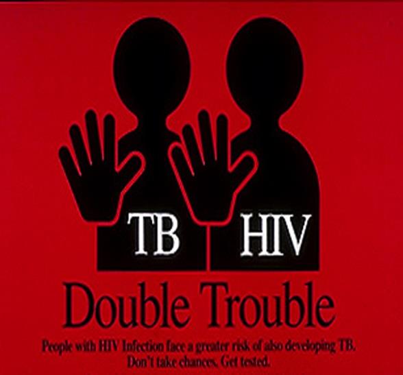 από το σύνολο των κρουσμάτων με φυματίωση (9εκατ) ήταν HIV-θετικοί, με 75% περιπτώσεις να