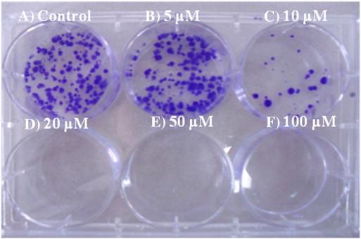 48 Εικόνα 4-8: Clonogenic Assay σε πλακίδιο έξι φρεατίων εικονίζονται ευδιάκριτα οι αποικίες.