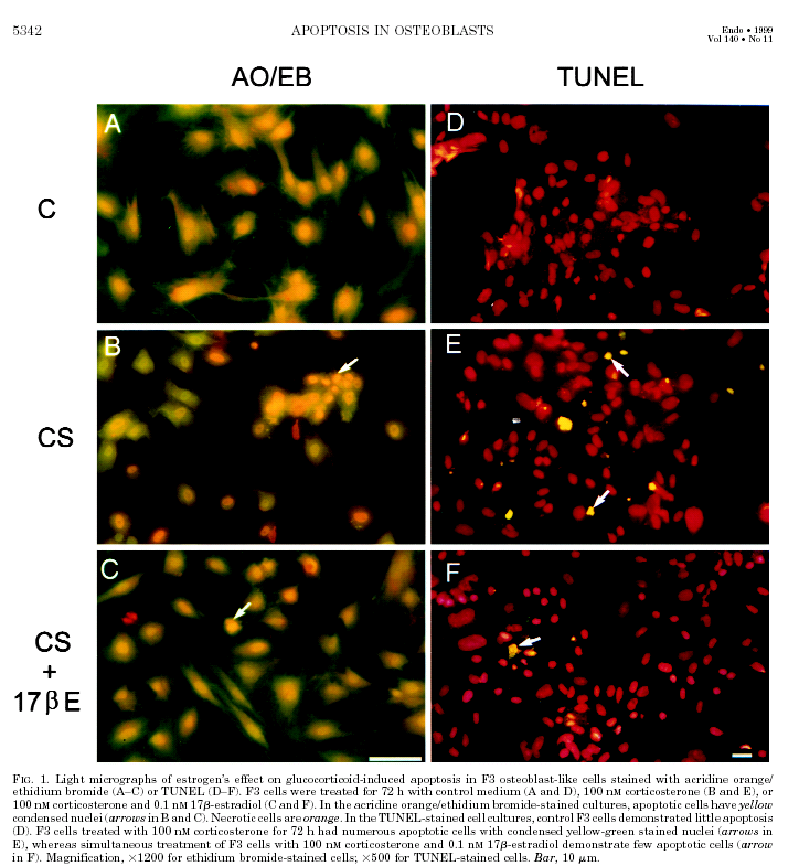 A Control medium Normal osteoblasts B Corticosterone Induced apoptosis Estrogens prevent CS induced