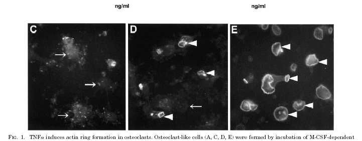 Leptin Leptin withdrawl Leptin withdrawl Actin rings Γείκηης ζηαδίοσ ΓιέγερζηςΟζηεοκλαζηών.