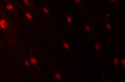 A CIS dapi Α CIS 0 GH200 0 GH200 GH1000 EGF GH1000 EGF Εικόνα: Ασθενής (0, GH200, GH1000, EGF): dapi CIS Μετά από επαγωγή με GH1000 και μετά από επαγωγή με EGF, η συγκέντρωση της πρωτεΐνης CIS είναι