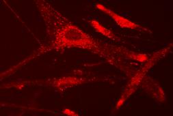 A EGFR dapi Α EGFR 0 GH200 0 GH200 GH1000 EGF GH1000 Εικόνα: Ασθενής (0, GH200, GH1000, EGF): dapi GHR EGF 6.