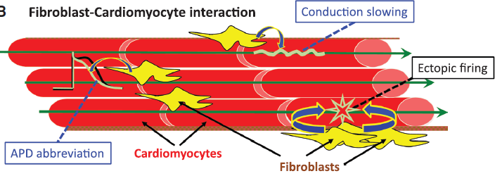 Fibrosis and atrial fibrillation Mechanisms-II Οι ινοβλάςτεσ εμφανίηουν και θλεκτρικι