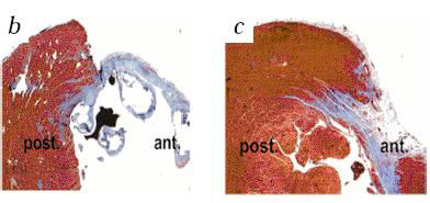 Myocardial Repair by mobilized stem cells Saline CD34+ HSC Differentiation into cardiomyocytes smooth muscle cells, endothelial cells (68% regenerated infarct) Possible