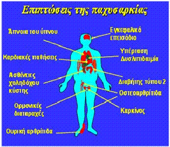 Επιπτώσεις μη ορθής διατροφής Παχυσαρκία