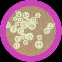 Penicillium Saccharomyces Tinea Stachybotrys Μέγιστο Μέγεθος (nm)... 33.000 16 Επικινδυνότητα...... 64 198.. Μέγιστο Μέγεθος (nm)... 10.000 Επικινδυνότητα... 19 1 184.. Μέγιστο Μέγεθος (nm)... 110.