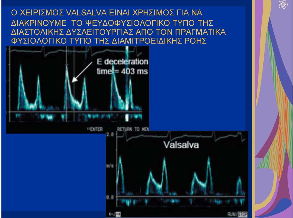 ΔΙΑΣΤΟΛΙΚΗΣ ΔΥΣΛΕΙΤΟΥΡΓΙΑΣ ΑΠΟ ΤΟΝ