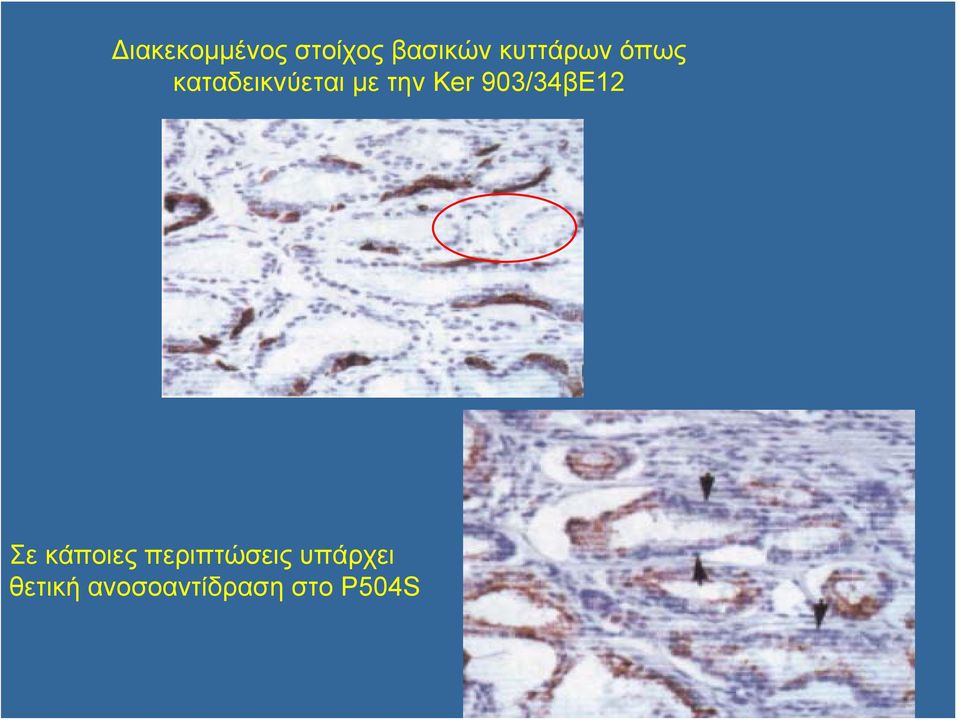 Ker 903/34βE12 Σε κάποιες