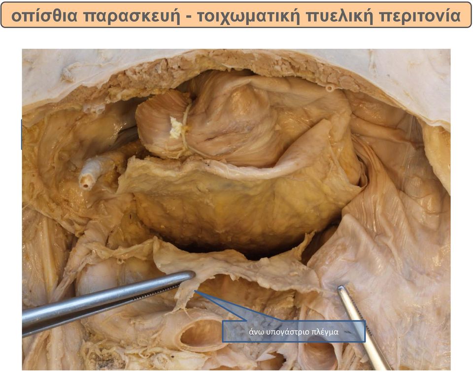 περιτονία rectum