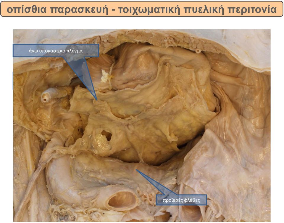 περιτονία άνω υπογάστριο