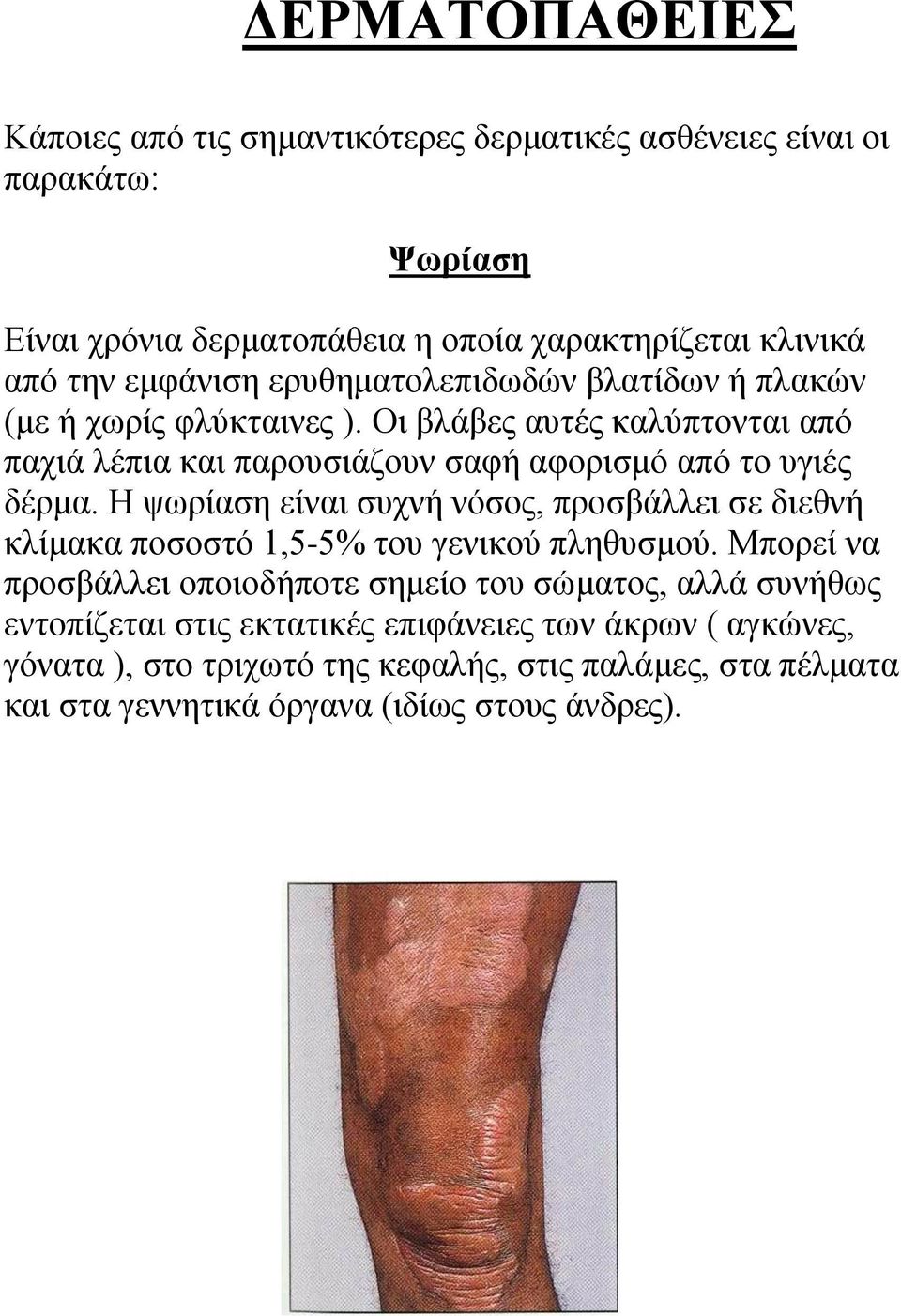 Οη βιάβεο απηέο θαιύπηνληαη από παρηά ιέπηα θαη παξνπζηάδνπλ ζαθή αθνξηζκό από ην πγηέο δέξκα.