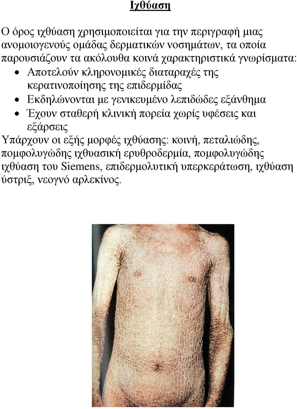 γεληθεπκέλν ιεπηδώδεο εμάλζεκα Έρνπλ ζηαζεξή θιηληθή πνξεία ρσξίο πθέζεηο θαη εμάξζεηο Τπάξρνπλ νη εμήο κνξθέο ηρζύαζεο: θνηλή,