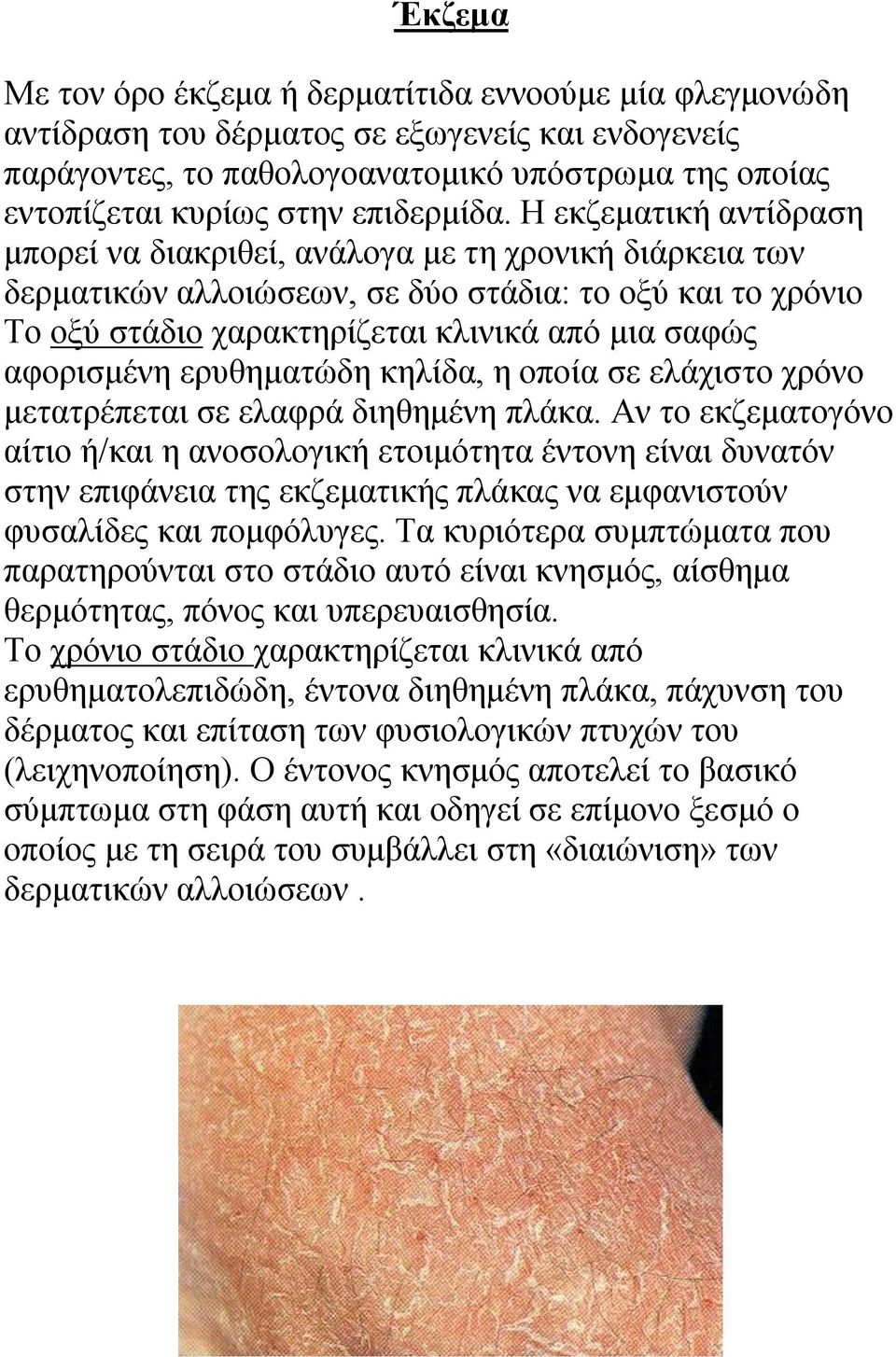 Ζ εθδεκαηηθή αληίδξαζε κπνξεί λα δηαθξηζεί, αλάινγα κε ηε ρξνληθή δηάξθεηα ησλ δεξκαηηθώλ αιινηώζεσλ, ζε δύν ζηάδηα: ην νμύ θαη ην ρξόλην Σν νμύ ζηάδην ραξαθηεξίδεηαη θιηληθά από κηα ζαθώο αθνξηζκέλε