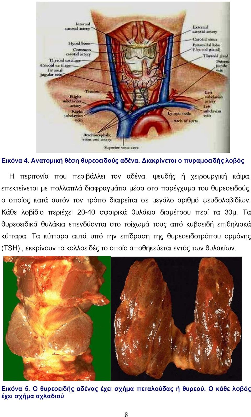 θυρεοειδούς, ο οποίος κατά αυτόν τον τρόπο διαιρείται σε μεγάλο αριθμό ψευδολοβιδίων. Κάθε λοβίδιο περιέχει 20-40 σφαιρικά θυλάκια διαμέτρου περί τα 30μ.