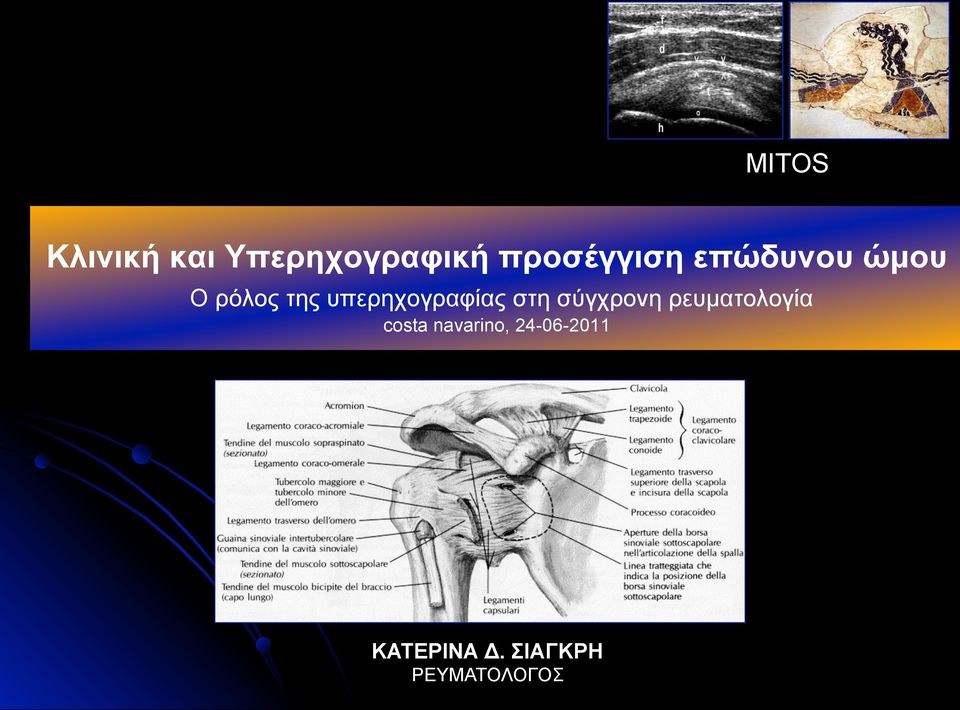 υπερηχογραφίας στη σύγχρονη ρευµατολογία